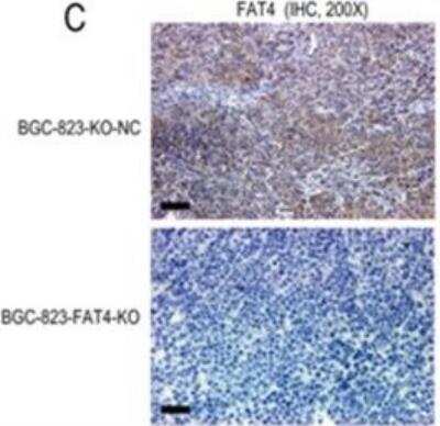 <b>Genetic Strategies Validation. </b>Knockout Validated: FAT4 Antibody [FITC] [NBP1-78381F] - Effect of FAT4 knockout on GC tumorigenesis in the nude mice xenograft model. Representative images show IHC staining of BGC-823-KO-NC and BGC-823-FAT4-KO derived xenograft tumors with antibody against FAT4 (NBP1-78381F). Scale bar, 100 um. Image collected and cropped by Citeab from the following publication (//pubmed.ncbi.nlm.nih.gov/29435168/) licensed under a CC-BY license.